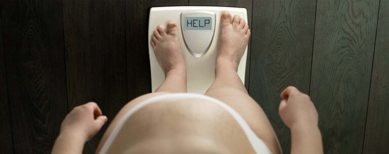 La obesidad y sus causas